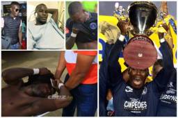 En julio vio frustrado su sueño de jugar en Europa y en septiembre sufrió una fractura de pómulo, pero hoy Rubilio Castillo festeja la Copa 16 con Motagua. Acá las imágenes del agridulce semestre que cierra.