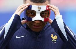 ¡Mbappé no podrá jugar con esta máscara!