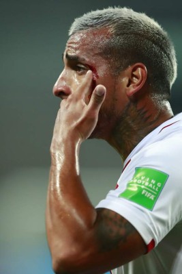 Fotos del Perú - Brasil: Las patadas a Neymar y la sangre de Miguel Trauco