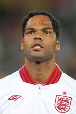 Halloween 2019: Los futbolistas más feos del mundo y el único en el Real Madrid