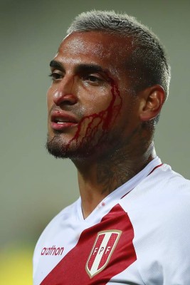 Fotos del Perú - Brasil: Las patadas a Neymar y la sangre de Miguel Trauco