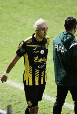 No se vio en TV: frustración aurinegra, festejos verdolagas, cabezas rotas y fuertes reclamos arbitrales