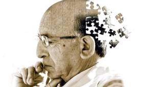 El Alzheimer es una enfermedad 1ue afecta a muchas personas de la tercera edad.