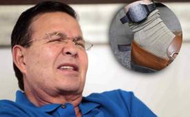 Rafael Callejas usará un grillete electrónico y deberá presentarse a Corte a firmar un libro. Foto DIEZ