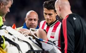 Shaw será operado en las próximas horas y estará varios meses al margen de los terrenos de juego.