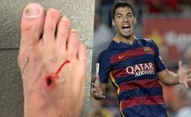 Filipe Luis publicó en su Instagram las foto de su pie tras el pisotón que le dio Luis Suárez y el uruguayo del Barcelona le respondió con todo.