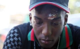 El jugador tiene las secuelas del accidente en su rostro.