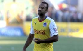 El defensor brasileño Fabio de Souza sigue mejorando de su salud.