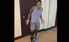 Luis Garrido muestra su evolución luego de la operación de rodilla.