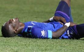 Rubilio Castillo salió lesionado en los instantes finales del juego en el Nacional.