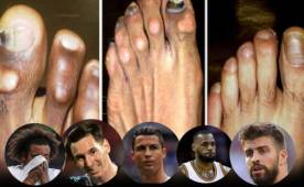 Todos les ven el físico, pero el deporte que practican es sacrificado y aún más sus pies. Mirá cómo son los pies más feos de los deportistas famosos. ¡Los de Cristiano, Harden, Ronaldo Nazario, Bolt y Di María asustan!
