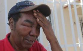 Entre lágrimas, Manuel Calderón le expresó a DIEZ que sus amigos lo han dejado solo e implora su presencia. Foto DIEZ