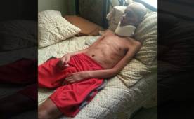 Enrique Centeno Reneau está en una cama en Jutiapa y necesita ayuda para seguir su tratamiento y levantarse de la misma. Foto Cortesía