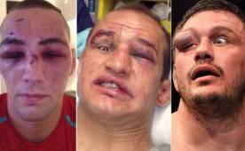 Las Artes Marciales Mixtas son uno de los deportes más violentos ye estas imágenes hablan más que mil palabras.