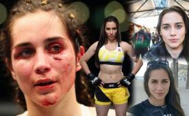 La venezolana Verónica Macedo tiene poco tiempo como peleadora profesional de la UFC, pero recibió tremenda golpiza que le causó daño a su precioso rostro.