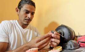 Núñez nos demostró cómo se hacen las dentaduras acrílicas.