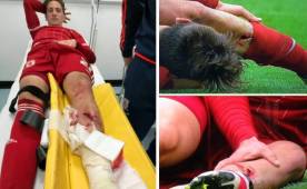 Tremendo planchazo a Gaston Ramirez: El jugador del Middlesbrough se retiro con oxigeno del campo.