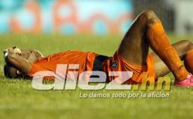 El delantero de Motagua Eddie Hernández lamenta una acción donde quedó adolorido.