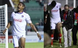 El delantero del Olimpoia, Carlo Costly, estará una semana de baja por una contractura muscular y se perdería el clásico del domingo ante Motagua.