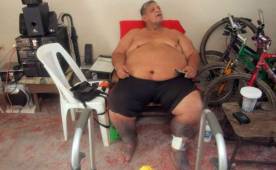 Rafael 'Paciencia' Núñez vive momentos difíciles de saluda e implora ayuda para no perder sus piernas, dice que Fenafuth le dijo que 'no'. Foto DIEZ