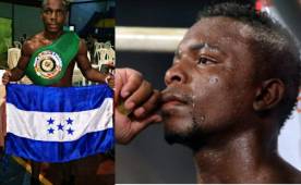 El boxeador hondureño 'Escorpión' Ruiz, ha logrado un triunfo de oro en Venezuela.