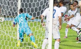 Honduras ha sido el objeto de críticas tras la derrota ante Guayana Francesa.