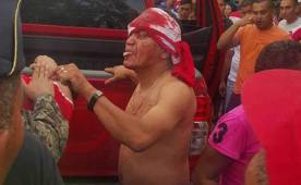 Este aficionado de Real Sociedad terminó con un cabeza ensangrentada.