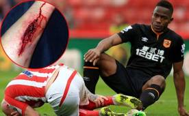 Maynor Figueroa provocó una herida a Stephen Ireland que le cuesta 12 puntos de sutura.