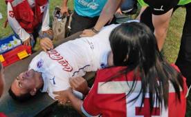 Arnold Peralta salió lesionado en el encuentro ante Real España.