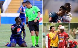 Estas son las imágenes que no se vieron en televisión de la Fecha 8 del torneo Apertura en Honduras.