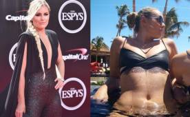 La hermosa Lindsey Vonn es una de las deportistas más bellas de la actualidad. El miércoles por la noche reapareció elegante en los Premios ESPY.