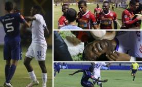 En Tegucigalpa hubo más patadas que fútbol. (FOTOS: DIEZ.HN)