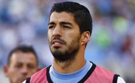 El delantero uruguayo no ha debutado con Uruguay en la Copa América Centenario por lesión.