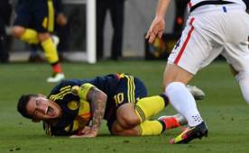 James resultó lesionado el sábado en el partido ante Estados Unidos.