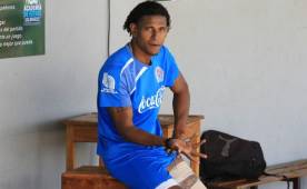 Carlo Costly sufrió un problema muscular en el amistoso ante Juticalpa.