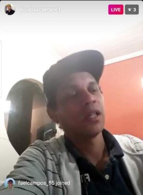 Douglas Caetano aparece en un Live de Instagram y sorprende con su maltratada apariencia
