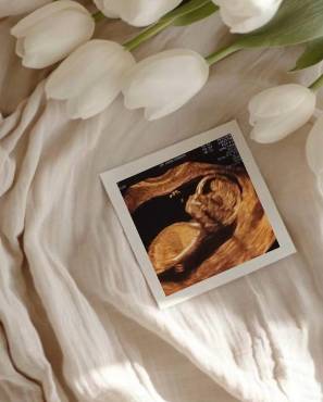 Futbolista de Olimpia es sorprendido por su pareja previo al partido amistoso ante el Inter de Miami