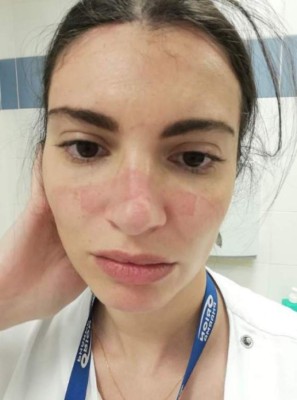 Fotos: Así lucen los rostros de los doctores que luchan contra el coronavirus