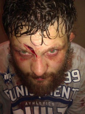 Fotos: Los golpes más espeluznantes en la UFC