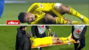 Luis Palma sufrió un duro golpe en su tobillo derecho y tuvo que salir del partido en camilla.