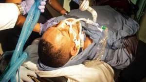 Han estado medicando a Camacho para que mejore en su condición, pero los mismos no le han respondido efectivamente.