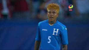 Henry Figueroa sorprendió en esta Copa Oro con este extraño y extravagante look.