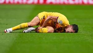 Robert Lewandowski podría estar hasta un mes de baja por una lesión en su tobillo izquierdo.