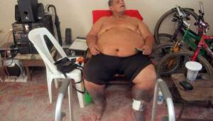 Rafael 'Paciencia' Núñez vive momentos difíciles de saluda e implora ayuda para no perder sus piernas, dice que Fenafuth le dijo que 'no'. Foto DIEZ