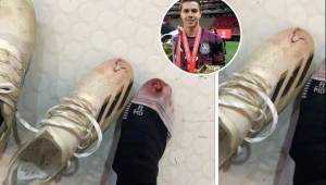 El futbolista salió con esta herida tras el México-Honduras en los Preolímpicos de Guadalajara.