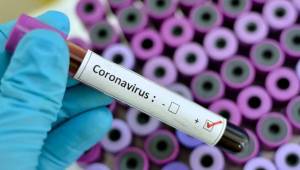 La Organización Mundial de la Salud (OMS) calificó este miércoles la expansión del coronavirus como 'pandemia'.
