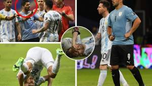 Te presentamos las mejores imágenes del Argentina-Uruguay de la Copa América, la albiceleste sumó un triunfo sufrido. Messi tuvo un gran dolor en una de sus piernas.