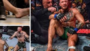 McGregor pierde su tercera pelea ante Poirier al sufrir impactante lesión en la UFC. Acá las imágenes de su tibia.