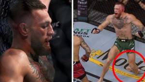 Así fue la impactante lesión de Conor McGregor en su pelea ante Dustin Poirier.