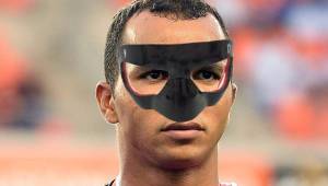 El portero del Olimpia, Donis Escober, jugará con una máscara protectora en su rostro en los partidos eliminatorios contra Estados Unidos y Costa Rica.